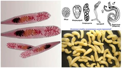  Paramfistula! Un Gusano Trematodo Con una Vida Compleja y Sorprendente